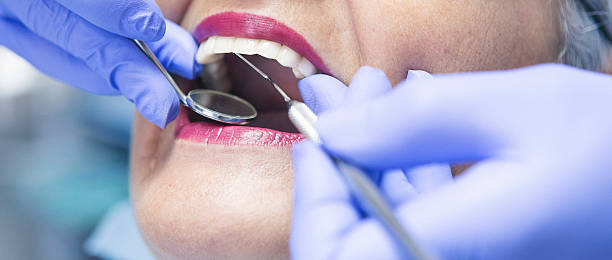 Best Mobile Emergency Dentist in Keystone, FL
